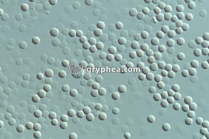 Hématies en milieu hypotonique x160 - gryphea.org